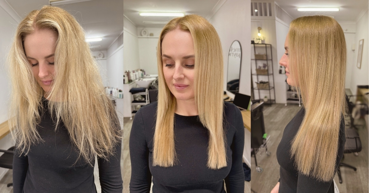 nanoplasty-gold-coast-before-and-after